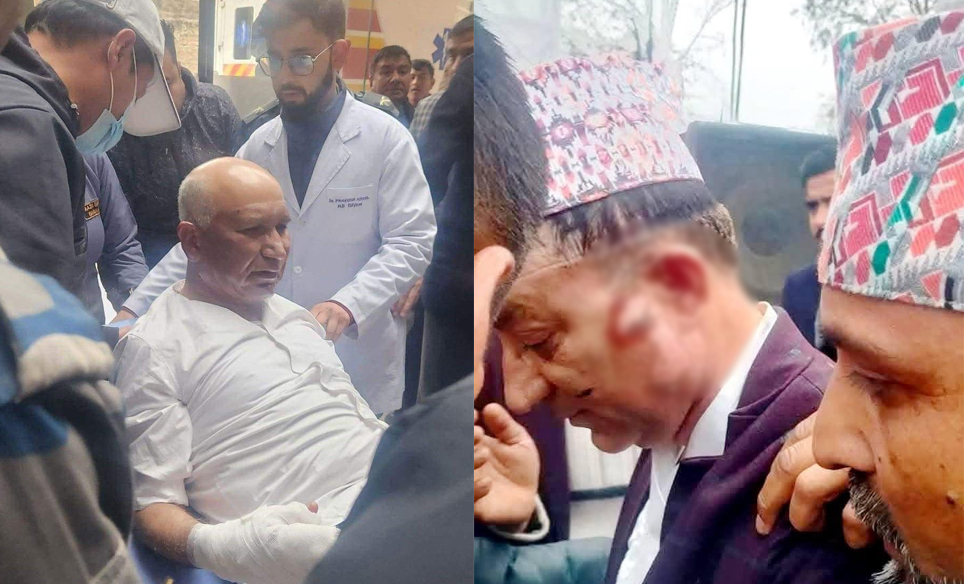 बेलुन पड्किएर घाइते भएका अर्थमन्त्री पौडेल अस्पतालबाट ‘डिस्चार्ज’