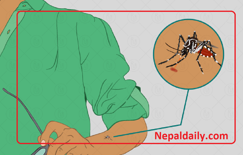 डेंगु संक्रमितको संख्या ३० हजार नाघ्यो, कुन प्रदेशमा कति सङ्क्रमित  ?
